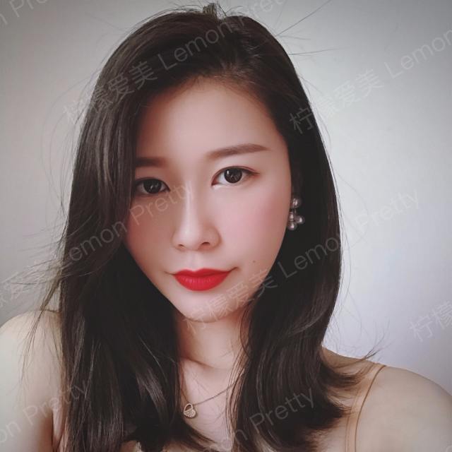 变美日记_真实体验经历_柠檬爱美_切开双眼皮