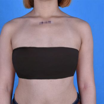 我想问下如何让乳晕缩小,乳晕大一点也不好看.